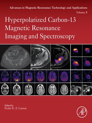cover image of Hyperpolarized Carbon-13 Magnetic Resonance Imaging and Spectroscopy